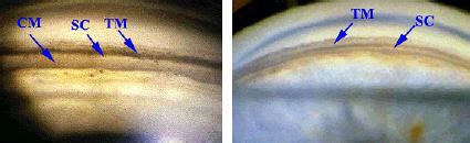 Angle Recession 的图像结果