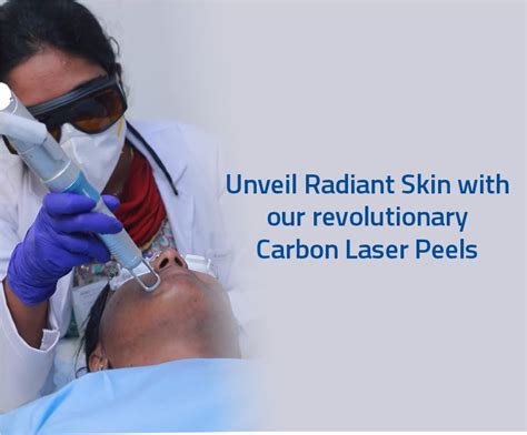 Carbon laser peel Aster Medcity | Aster