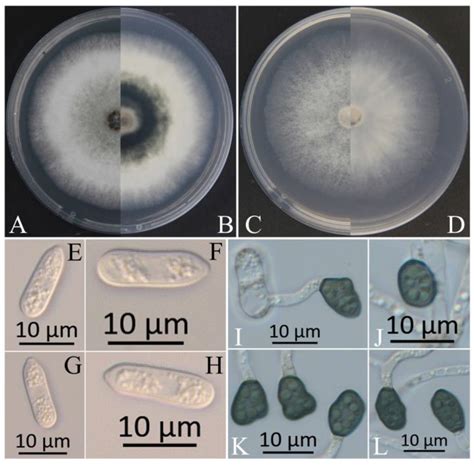 Species of the Colletotrichum spp., the Causal Agents of Leaf Spot on ...