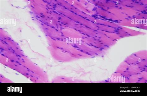 Image result for Skeletal Muscle Tissue Under Microscope