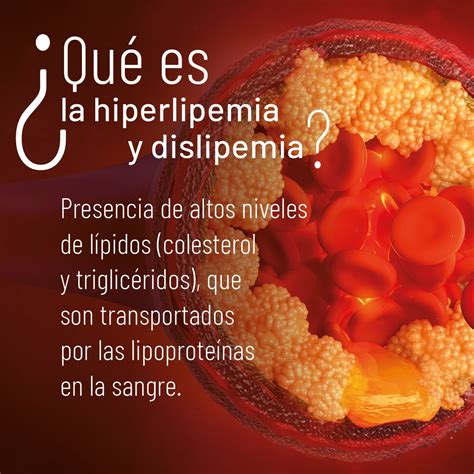 Hiperlipidemia Que Es