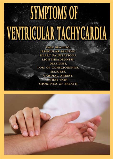 Symptoms Of Ventricular Tachycardia Fast Beating Irregular Beating ...