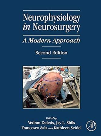 Neurophysiology in Neurosurgery: A Modern Approach eBook : Deletis ...