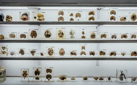 NIMHANS Brain Museum Bangalore - India's Only Brain Museum, Located in ...