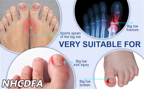 NHCDFA Bunion Corrector for Women, Bunion Thumb Corrector, Right Foot ...