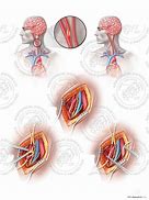 Image result for carotid 大鼠