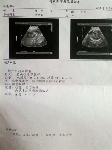 帮忙看下这份血检报告，是怀孕了吗？ - 百度宝宝知道