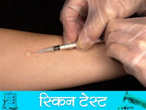 In Pics: 5 Essential Medical Test For Every Teenager From Age Of 18-25 ...