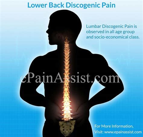 Lower Back Discogenic Pain: Treatment, Causes, Symptoms, Signs