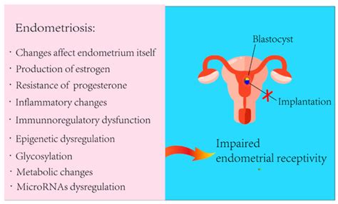 Towards a Better Understanding of Endometriosis-Related Infertility: A ...