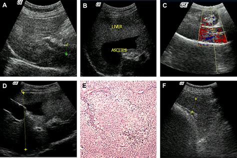 Image result for Ultrasound Lab