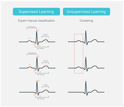 Current and Future Use of Artificial Intelligence in Electrocardiography