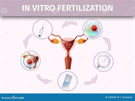 Image result for In Vitro Reproduction