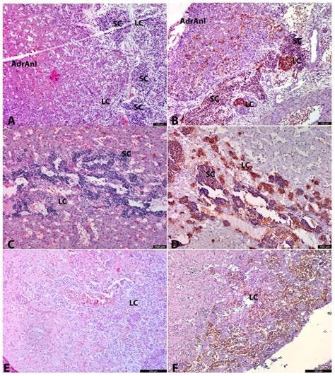 Developmental Parallels Between the Human Organs of Zuckerkandl and ...