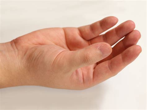 Image result for High-Resolution Hand MRI