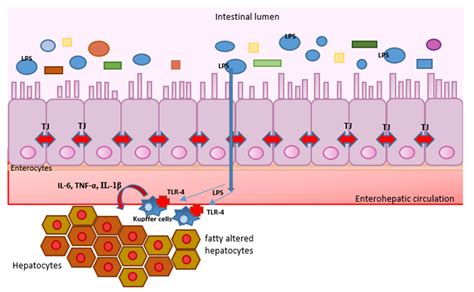 Alcohol, Inflammation, and Microbiota in Alcoholic Liver Disease