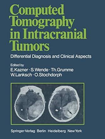 Buy Computed Tomography in Intracranial Tumors: Differential Diagnosis ...