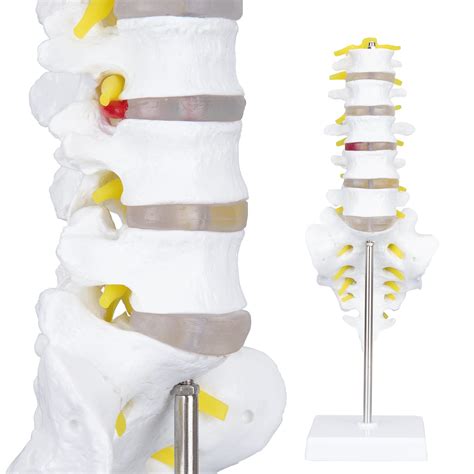 Buy LVCHEN Human Spine Anatomy Model - 1:1 Life Size Lumbar Vertebrae ...