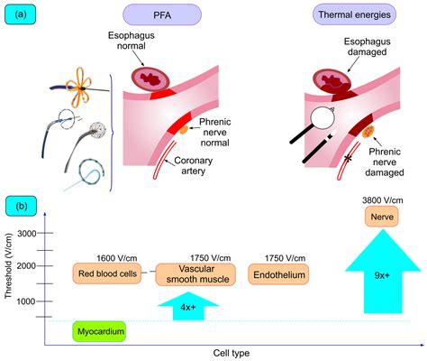 Pulsed Field Ablation of Atrial Fibrillation: A Novel Technology for ...