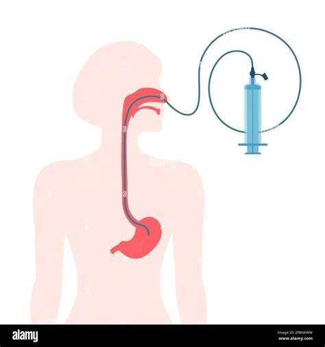 Nasogastric Tube And Trachea Nursing Model Nasogastric, 59% OFF