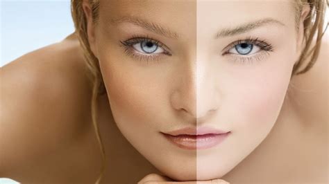 El blanqueamiento de la piel | Meer