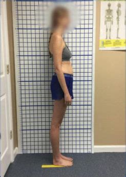 Image result for Structural Integration Exercises