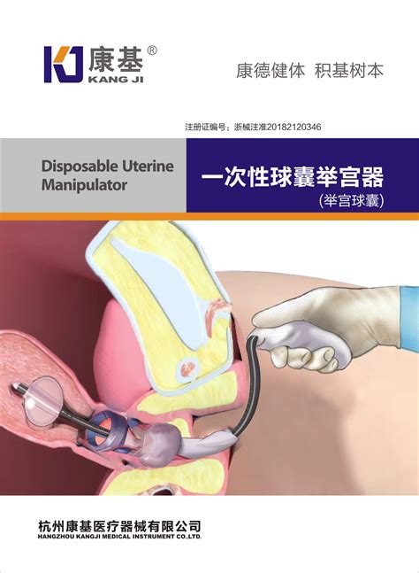一次性球囊举宫器-杭州康基医疗器械有限公司