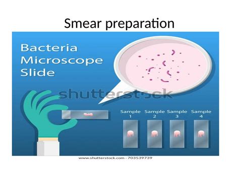 Image result for Simple Stain Procedure