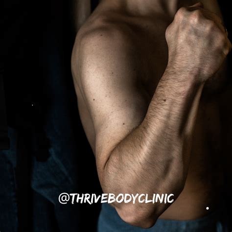 Image result for Extensor Digitorum Hand