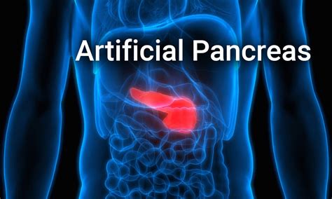 For the first time, researchers trial artificial pancreas on ...
