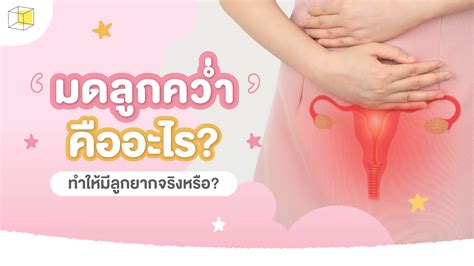 มาไขข้อข้องใจกัน! มดลูกคว่ำ ทำให้มีลูกยากจริงหรือ?