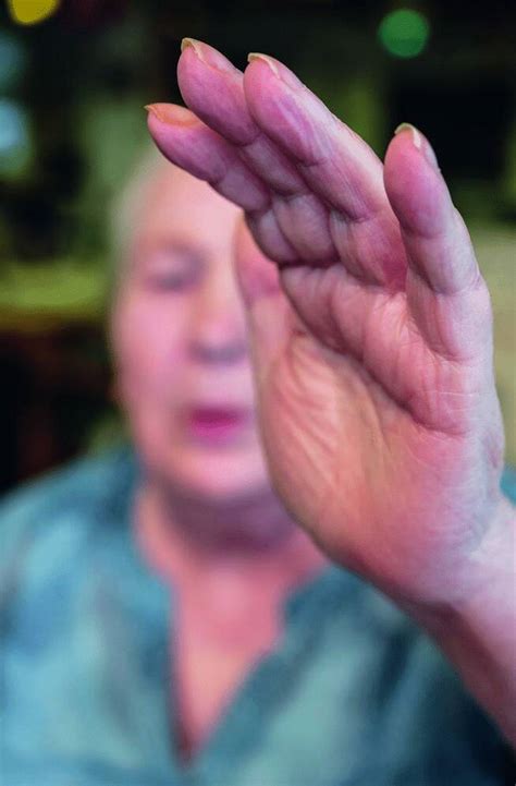 Schmerzassessment: Instrumente richtig nutzen