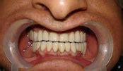 Patient's Photo Gallery | Dental Renaissance | Best Dental Clinic in Delhi