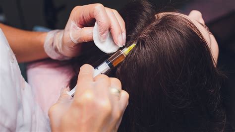 Platelet Rich Plasma - PRP Hair Restoration - #1 Rejuvenation Center in Bentonville, Arkansas