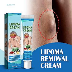 BOLINAO Lipoma Remover Cream Painless Herbal Lipolysis Fat Relief ...