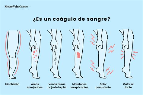 Coágulos de sangre en los tobillos, pies y piernas | Metro Vein Centers