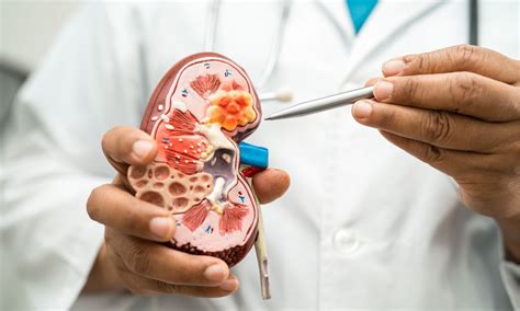 Higher serum Lipoprotein A level independent risk factor for mildly ...