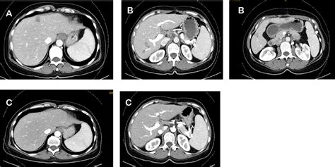 Image result for Effect CT Scan