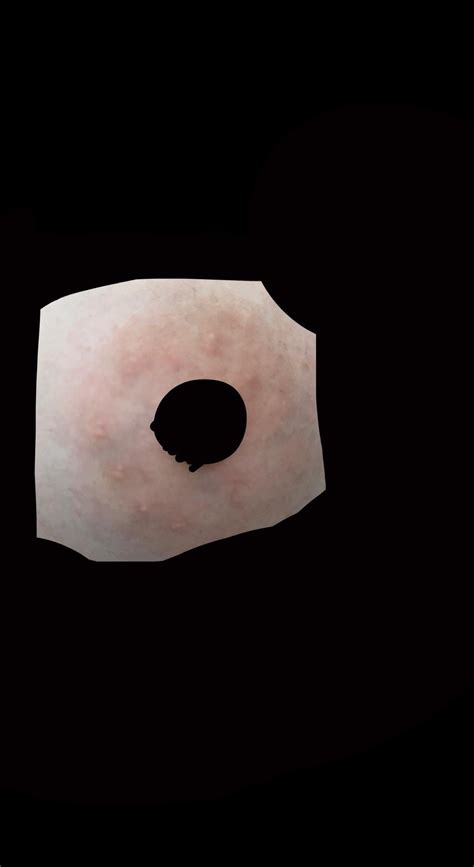 Why Are There Bumps On My Nipples at Madeleine Darbyshire blog