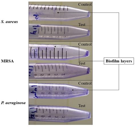 An Evaluation of the Antibacterial and Cytotoxic Activities of ...