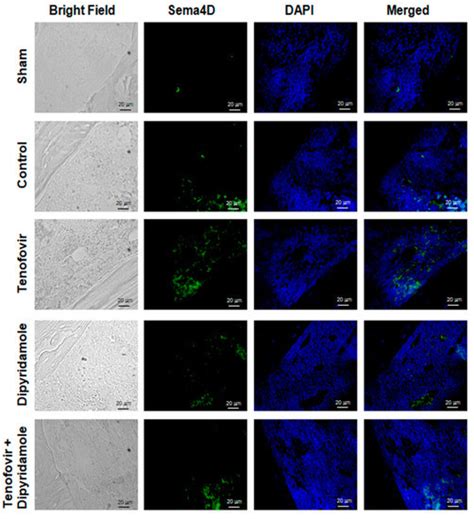 Tenofovir Modulates Semaphorin 4D Signaling and Regulates Bone ...