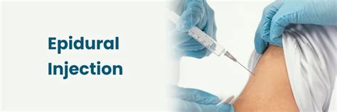 Image result for Epidural Injection Procedure