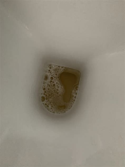 Bubbles In Urine Protein at Hazel Phillips blog