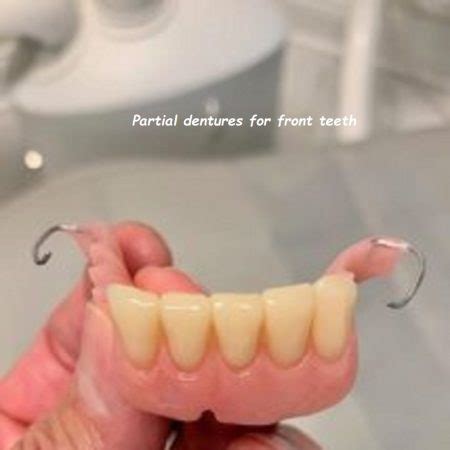 Image result for Bottom Front Teeth Partials