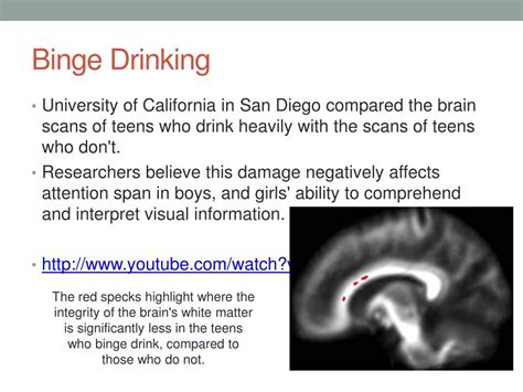 Image result for Prefrontal Cortex Damage