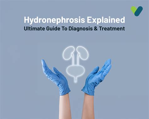 Hydronephrosis Explained: Ultimate Guide to Diagnosis & Treatment