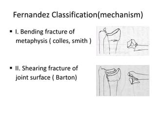 Image result for Open Reduction Distal Radius Fracture