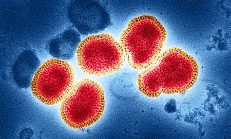 Two Dead Due to H3N2 Flu Virus in India, Confirms Health Ministry - The ...