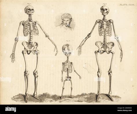 Comparison of the skeletons of the human male, female and foetus at birth. Copperplate engraving ...