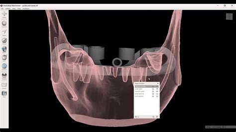 Image result for Stackable Guide Dailymotion